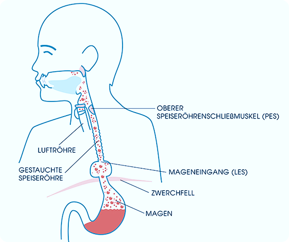 Ein besonderes Risiko